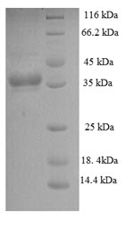 (Tris-Glycine gel) Discontinuous SDS-PAGE (reduced) with 5% enrichment gel and 15% separation gel.